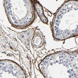Fibulin 5/DANCE Antibody, Novus Biologicals:Antibodies:Primary Antibodies